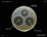 vibrio cholerae susceptibility testing